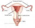 Cervicitis clamidial (Clamidia)