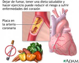 El tabaquismo, la hipertensión y el colesterol alto son los factores de riesgo para padecer enfermedades cardíacas y cardiovasculares. El tabaquismo, la hipertensión y el colesterol alto son los factores de riesgo para padecer enfermedades cardíacas y cardiovasculares.