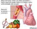 Factores de riesgo de padecer enfermedades cardacas y cardiovasculares