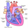 Insuficiencia pulmonar (insuficiencia de la vlvula pulmonar) [C. cardiovasc.]
