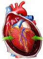 Taponamiento cardaco (presin cardaca por liquido) [C. cardiovasculares]