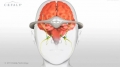 Cefaly (STX-Med): Tecnologa contra las migraas