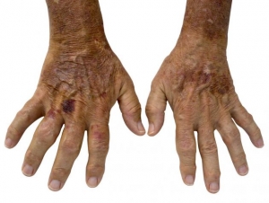 (Foto: Vida Salud)
