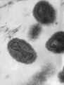 Erradicacin global de la viruela