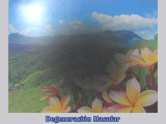 As ve una persona con degeneracin macular