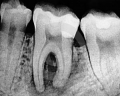 Radiografa dental, una imagen ms all de los dientes