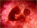 Disminuyen cifras de abortos en el mundo (1995-2003)