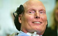 Christopher Reeve, Fallecio Christopher Reeve, la muerte de Superman, murio Superman, escaras, muerte por paralisis, infeccin sistmica, fractura de vertebra cervical, daos en su espina dorsal 