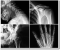 Mdico Traumatlogo, especialista en el tratamiento quirrgico u ortopdico de lesiones oseas musculoesquelticas